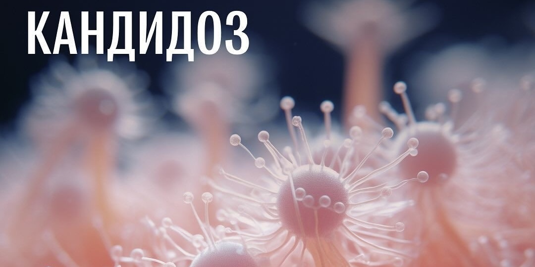 Кандида живет в каждом из нас, но мы можем ею управлять. Как бороться с ней и сохранить здоровье?