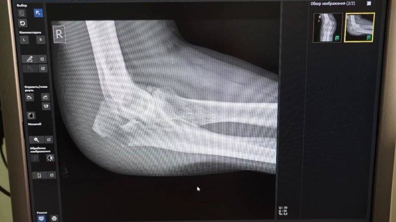     Травма. Травмпункт. Предоставлено altapress.ru