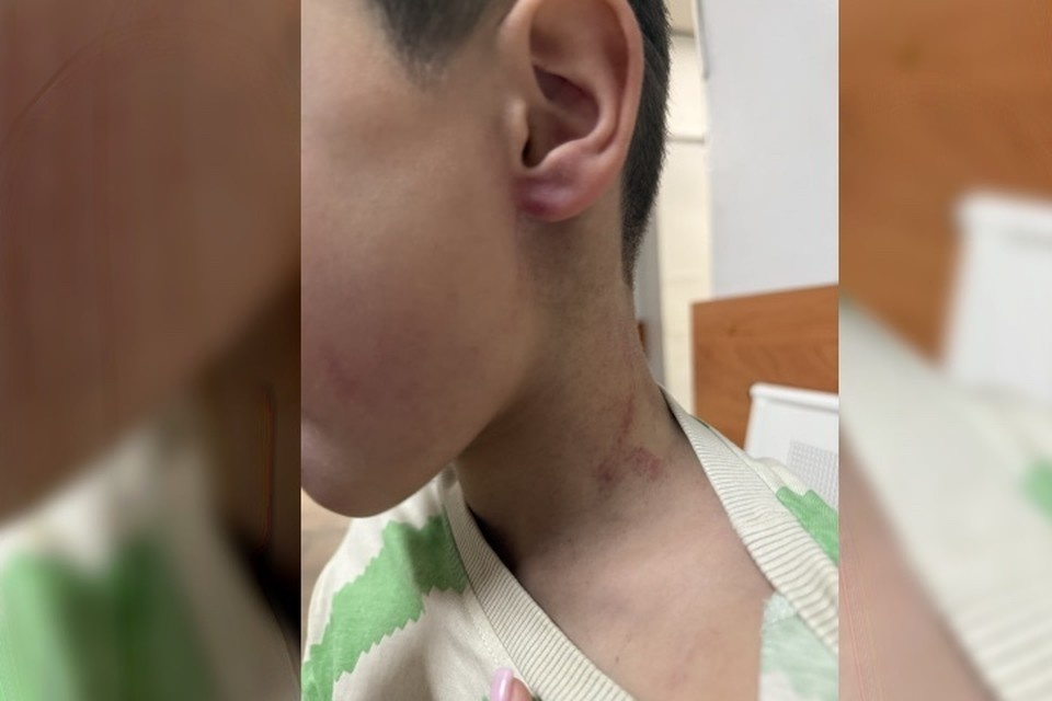    В детском саду поселка Молодежный тренер нанес ребенку травмы головы и лица. Фото: социальные сети межрегионального центра по правам детей