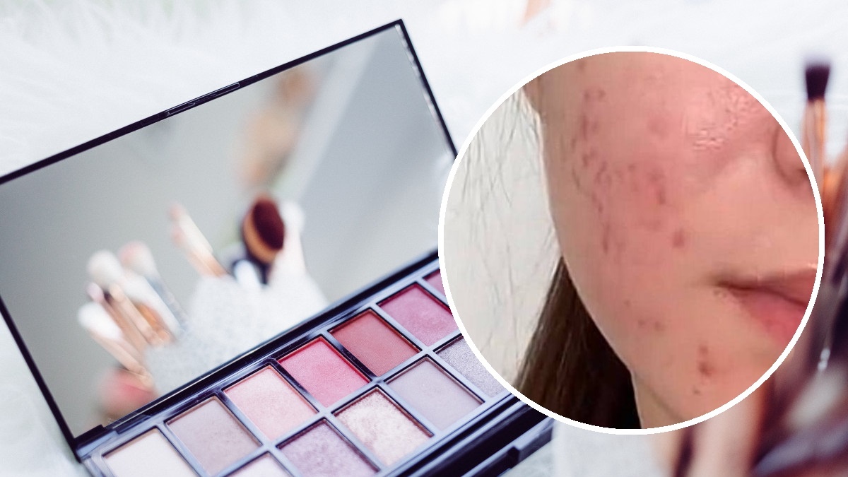 Фото: тг-канал Baza; pxhere.com