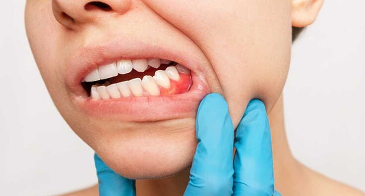 ИМЕЮТСЯ ПРОТИВОПОКАЗАНИЯ, НЕОБХОДИМА КОНСУЛЬТАЦИЯ СПЕЦИАЛИСТА