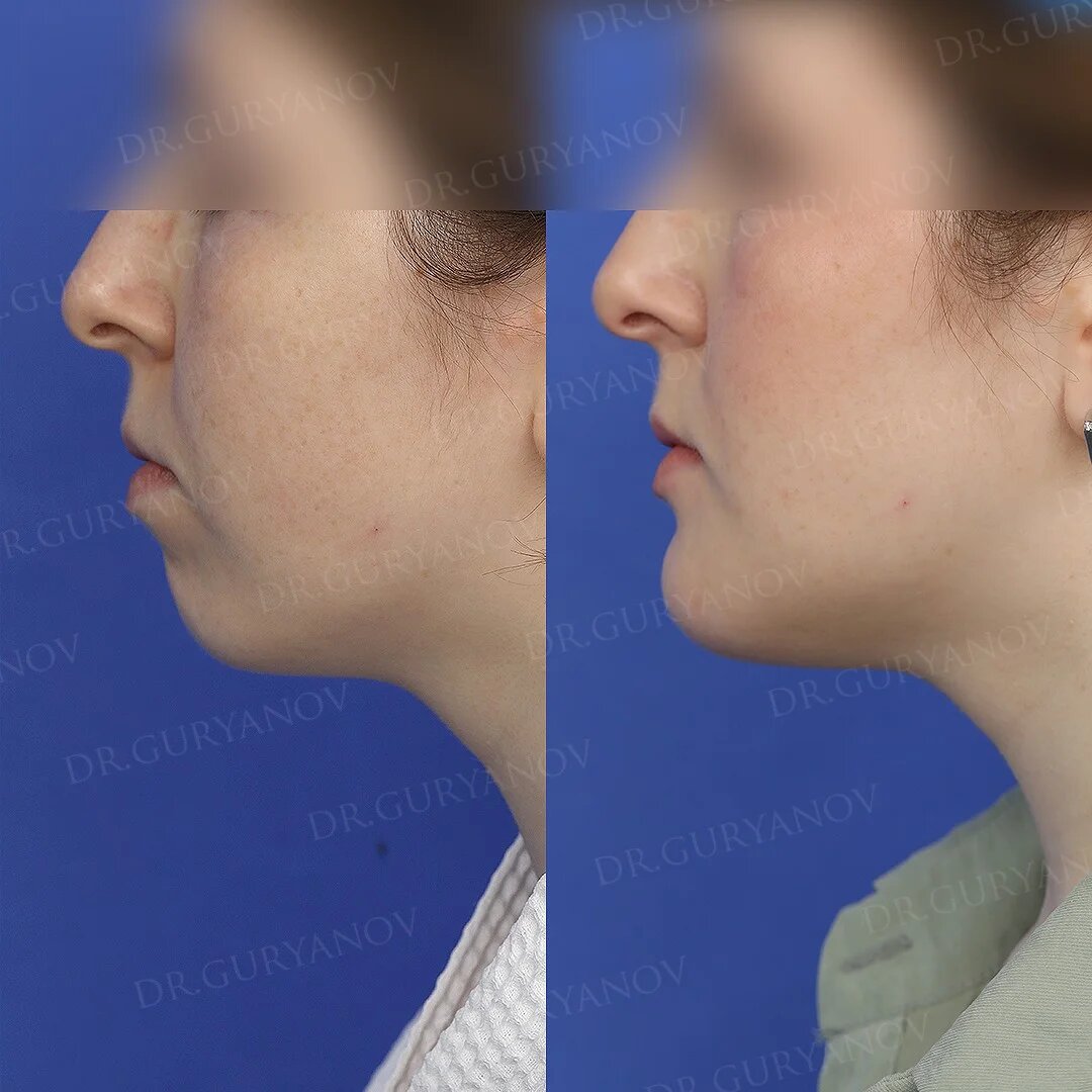 https://gurianov-clinic.ru/maxillofacial
