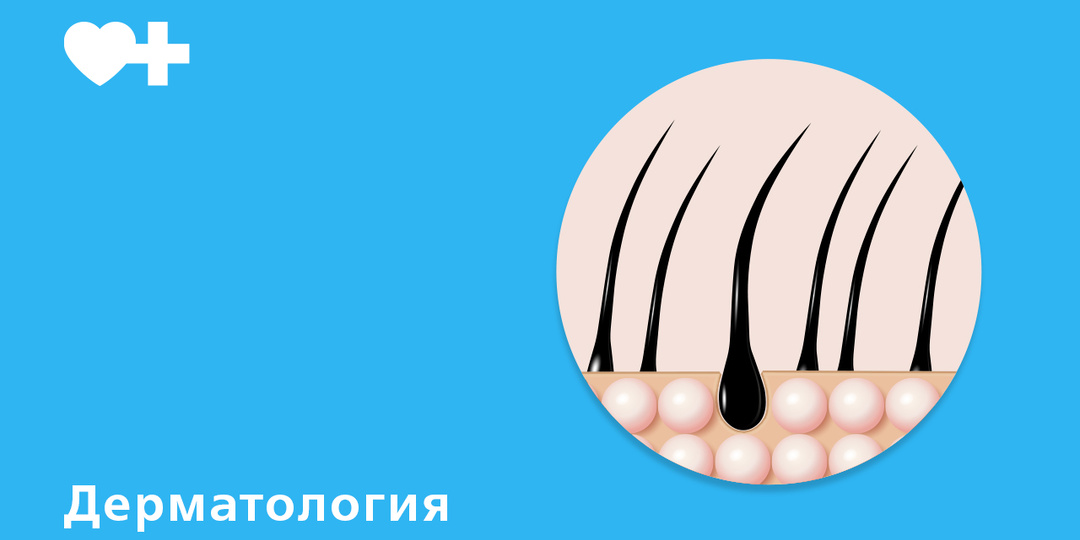 Сезонное выпадение волос: 5 ошибок, которые всё только ухудшают