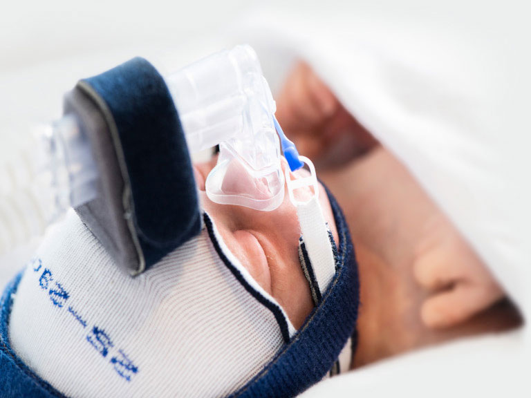 Иногда лечение проводится аналогично лечению легочных проблем у недоношенных, с помощью аппарата CPAP, который создает небольшое положительное давление дыхательных путях и не дает легким "слипаться" на выдохе