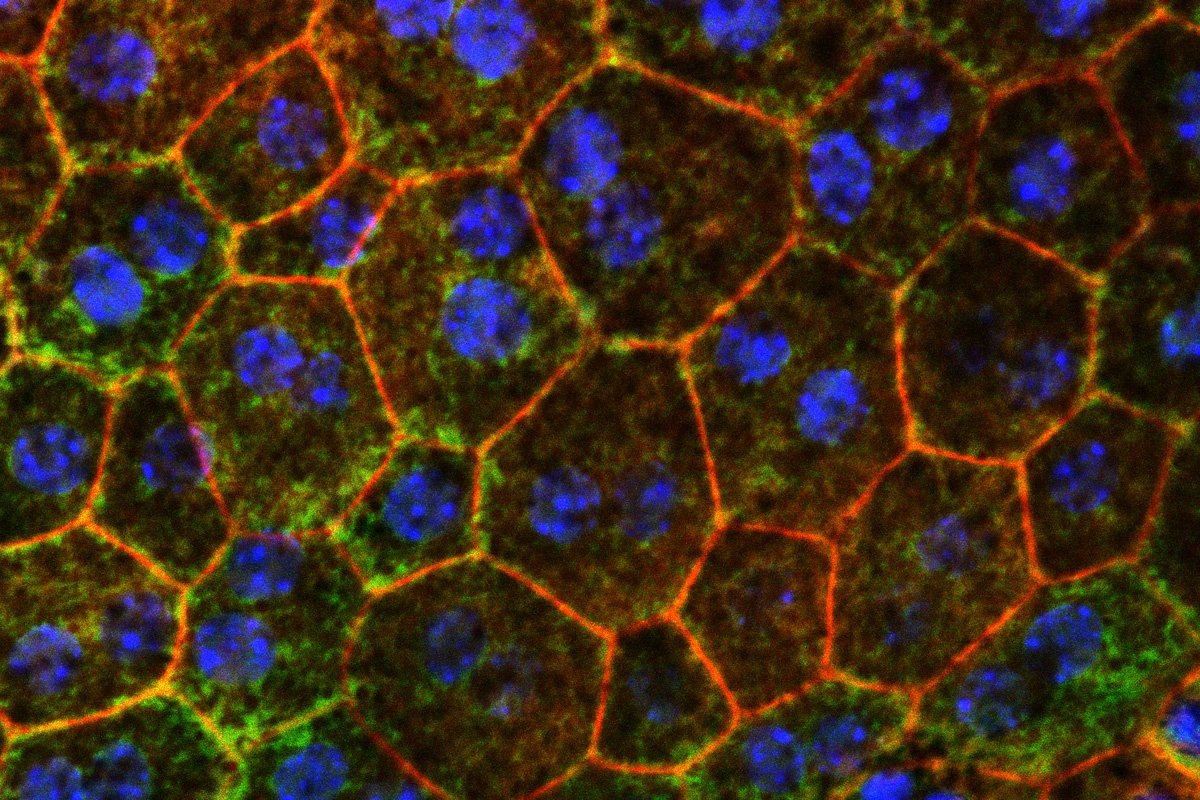   Ключевую роль в накоплении внутри клетки вредоносных белков играют лизосомы