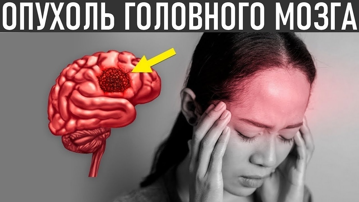 Когда Головная Боль — Это Не Давление, А Скрытая Опухоль