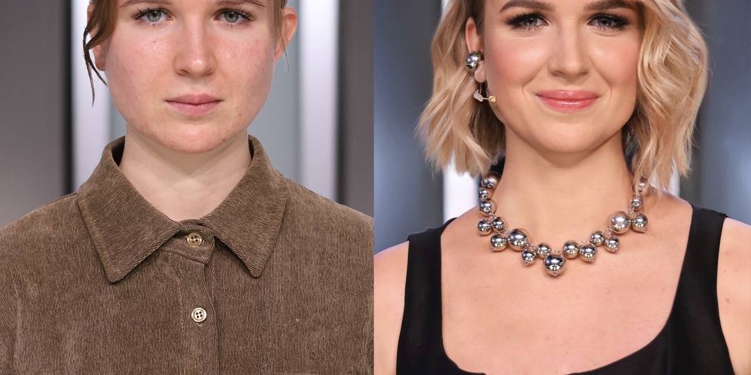 «Я состарилась в свои 24 года»