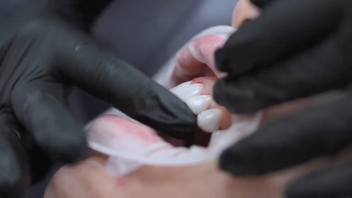 ИМЕЮТСЯ ПРОТИВОПОКАЗАНИЯ, НЕОБХОДИМА КОНСУЛЬТАЦИЯ СПЕЦИАЛИСТА