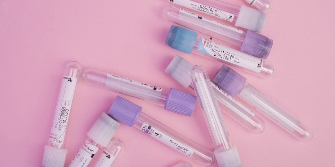 Анализы, которые нужно сдавать обязательно, чтобы не пропустить опасные заболевания