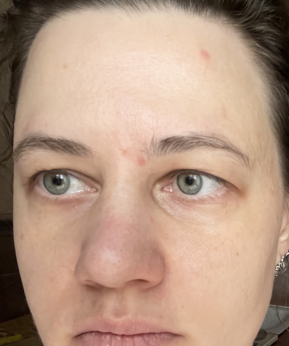 Крем Apoterm и сыворотка из этой же серии