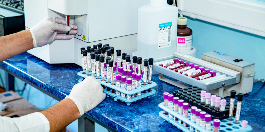 Какие анализы обязательно сдавать ежегодно после 40 лет — ваш путь к долгой и здоровой жизни