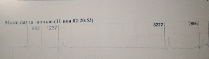 8222 - это продолжительность паузы в миллисекундах. Более 8 секунд.