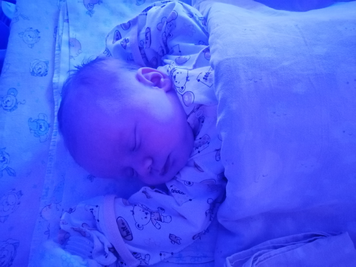 ОПН, после операции