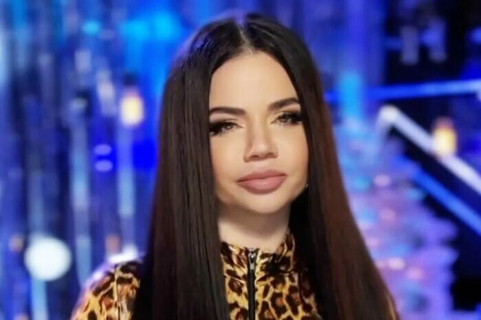 Бьянка после пластики.