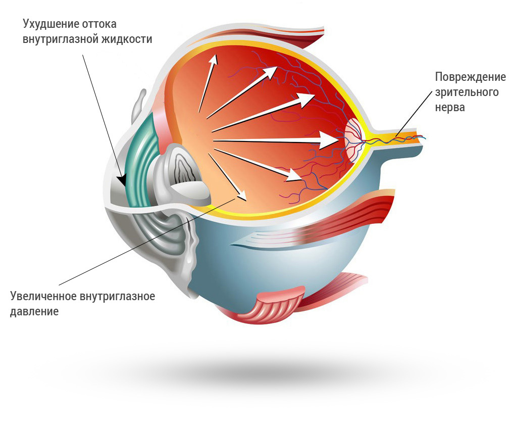 Источник: fedorovmedcenter.ru