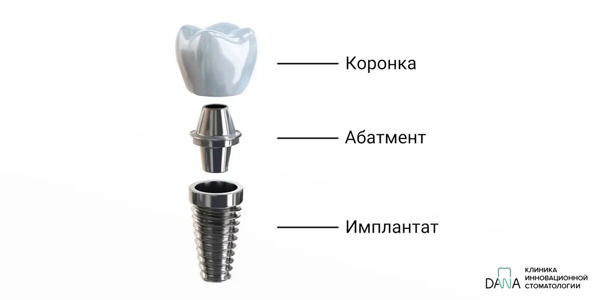 Рис. 1. Строение импланта