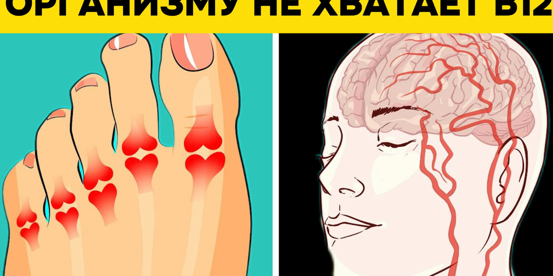 Дефицит витамина B12: 8 сигналов по версии врачей