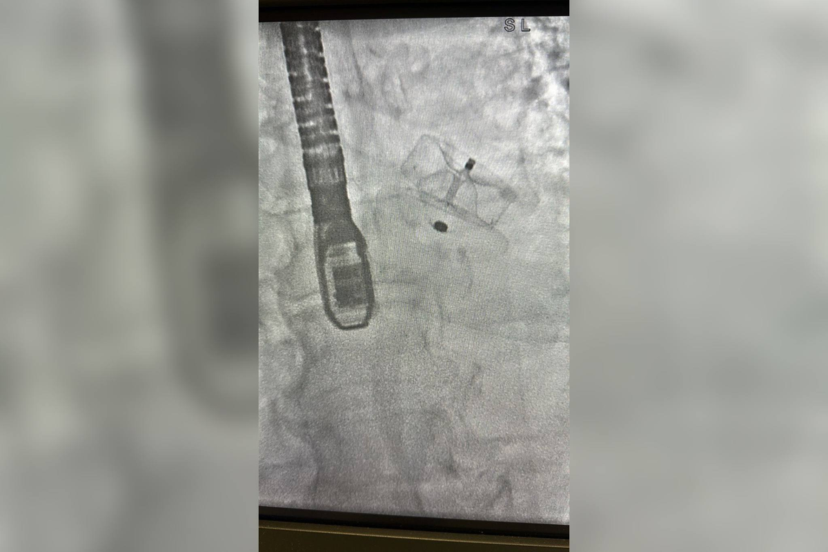 Фото: СПб ГБУЗ «Городская Мариинская больница»
