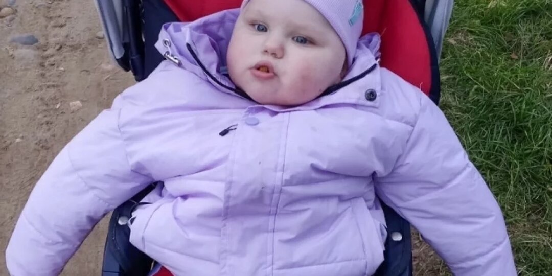 Весящая больше 27 кг 10-месячная девочка нуждается в помощи в Прикамье