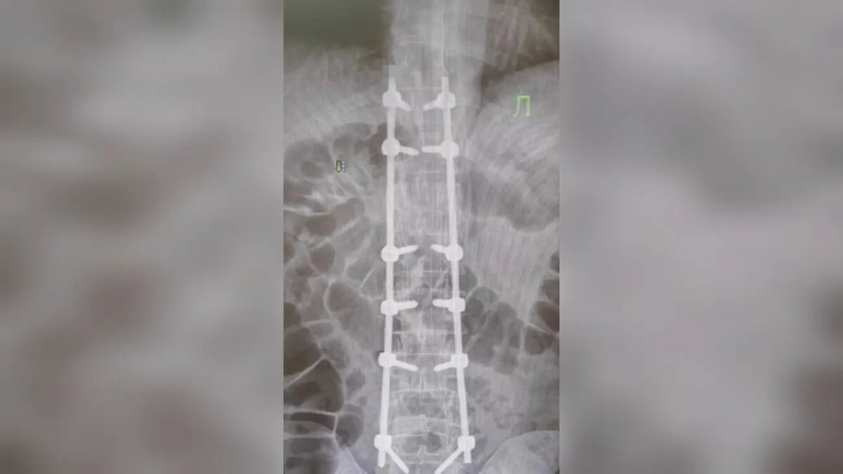 Фото:пресс-служба Минздрава Ингушетии