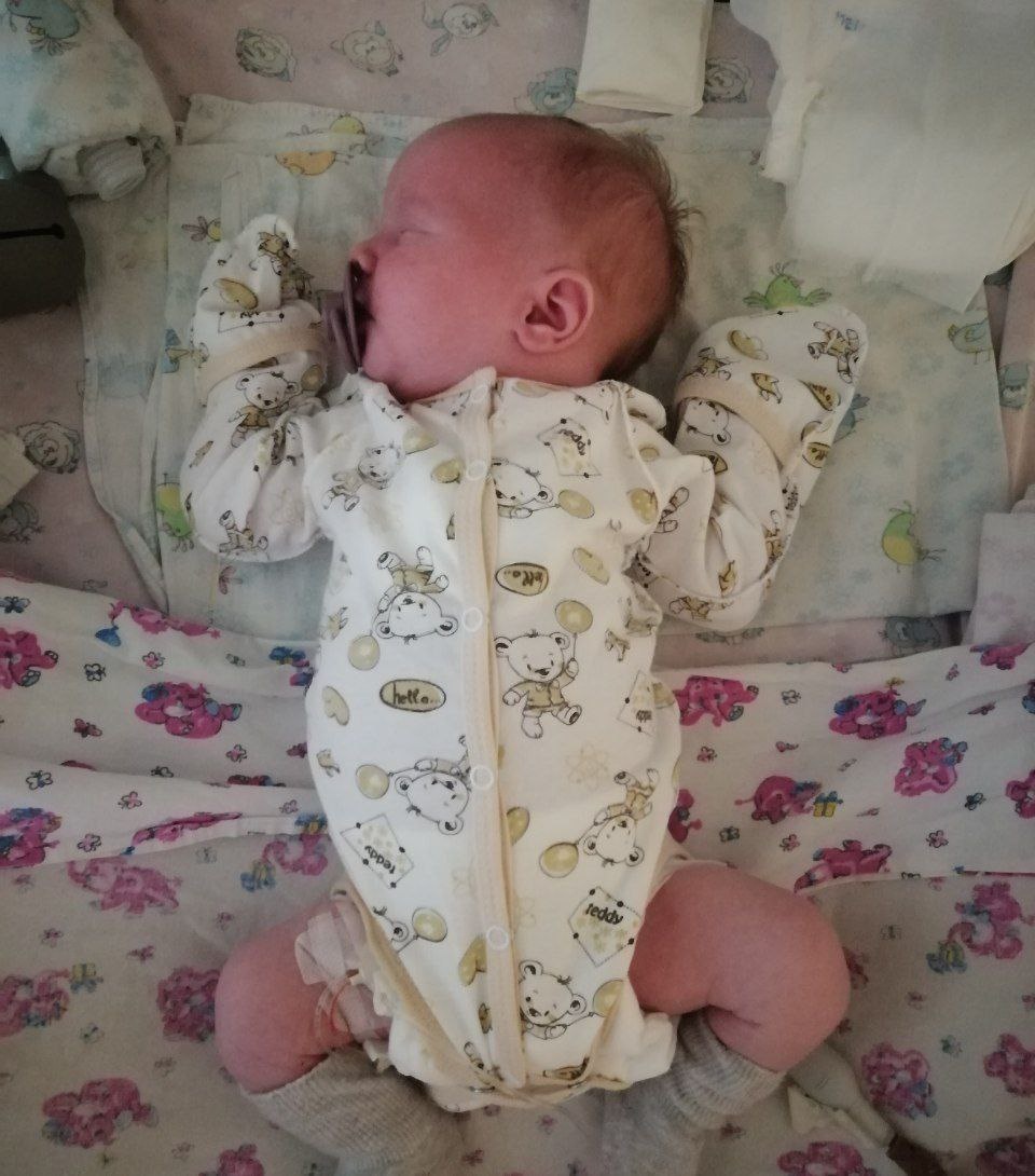 Слева вверху - трубка для подачи кислорода, завернута в пелёнку