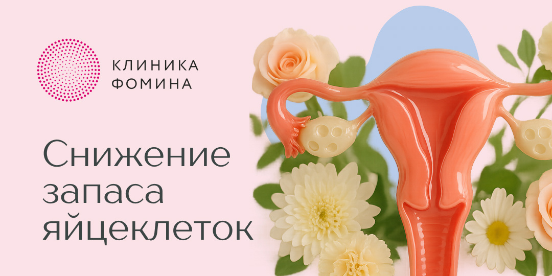 Преждевременная недостаточность яичников: как вовремя заметить и что делать