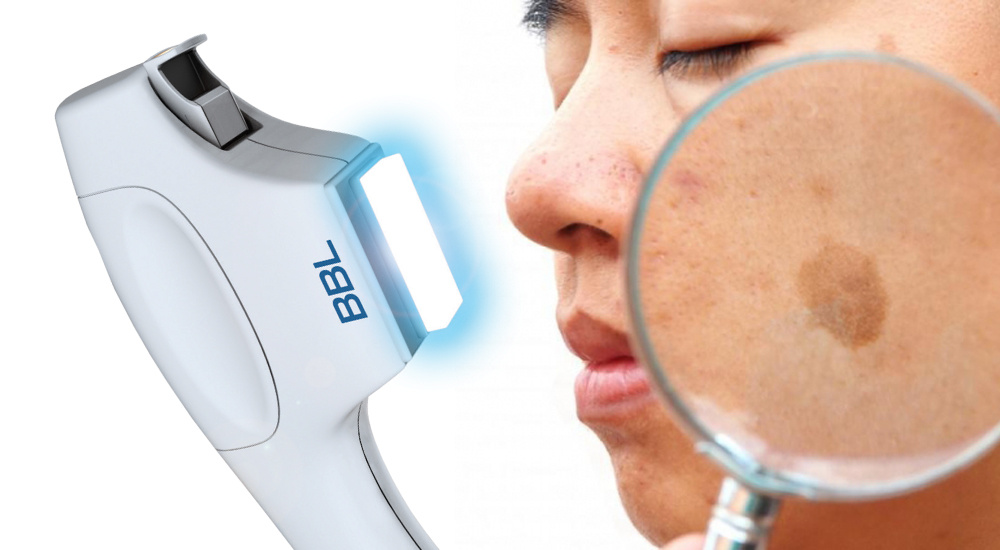 ИМЕЮТСЯ ПРОТИВОПОКАЗАНИЯ, НЕОБХОДИМА КОНСУЛЬТАЦИЯ СПЕЦИАЛИСТА