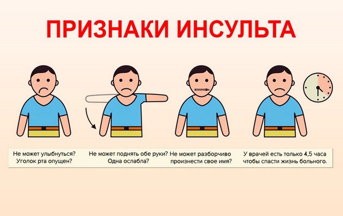 Инсульт без Высокого Давления: Как Распознать Первые Признаки — Совет Невролога