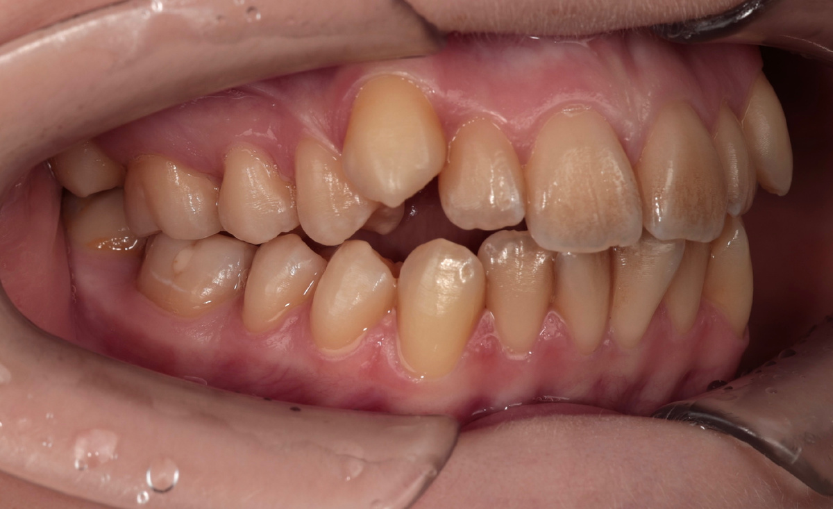 Фото до коррекции