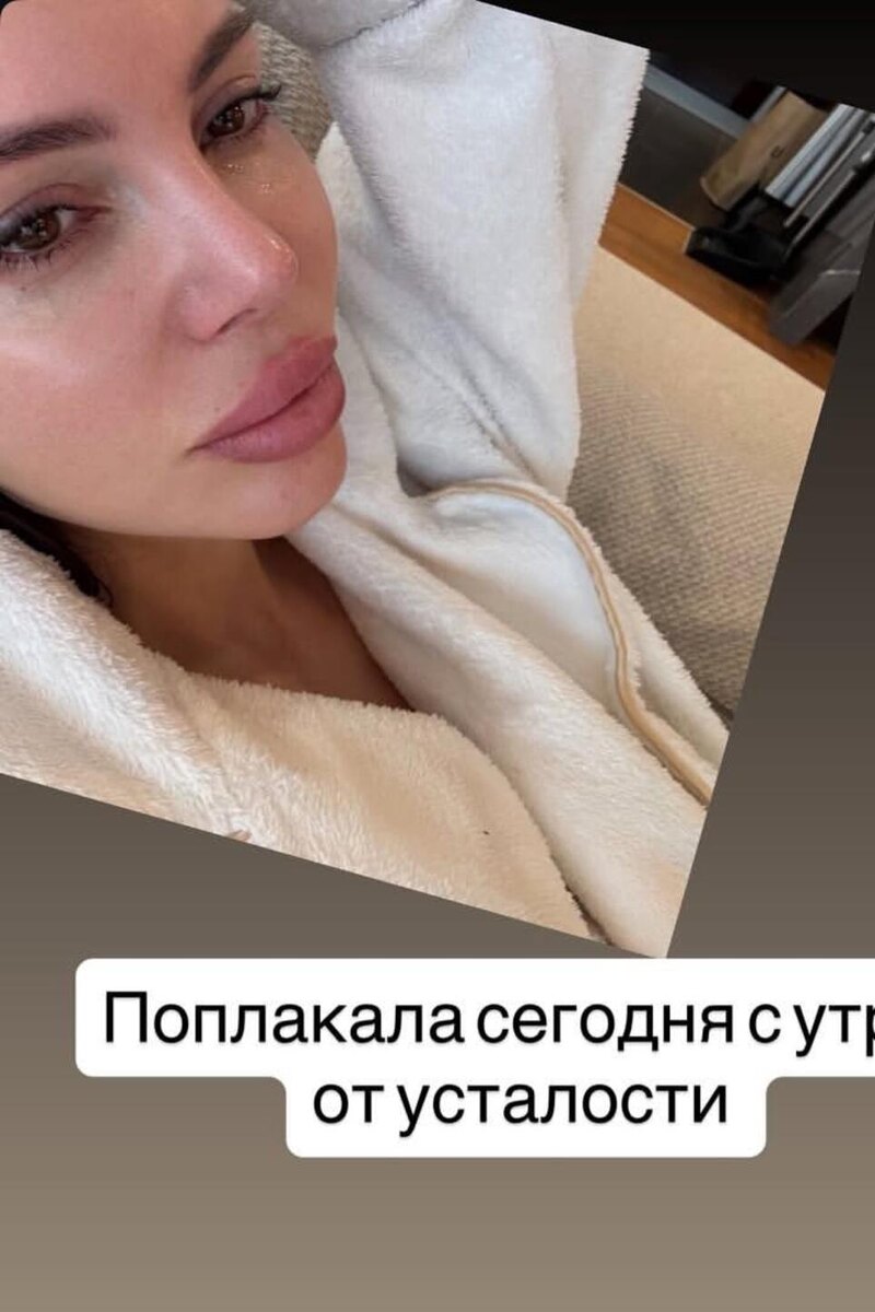    Оксана Самойлова Соцсети