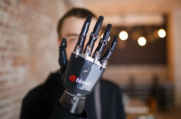 (И почему теперь заглядываюсь на людей с протезами с неподдельным интересом)