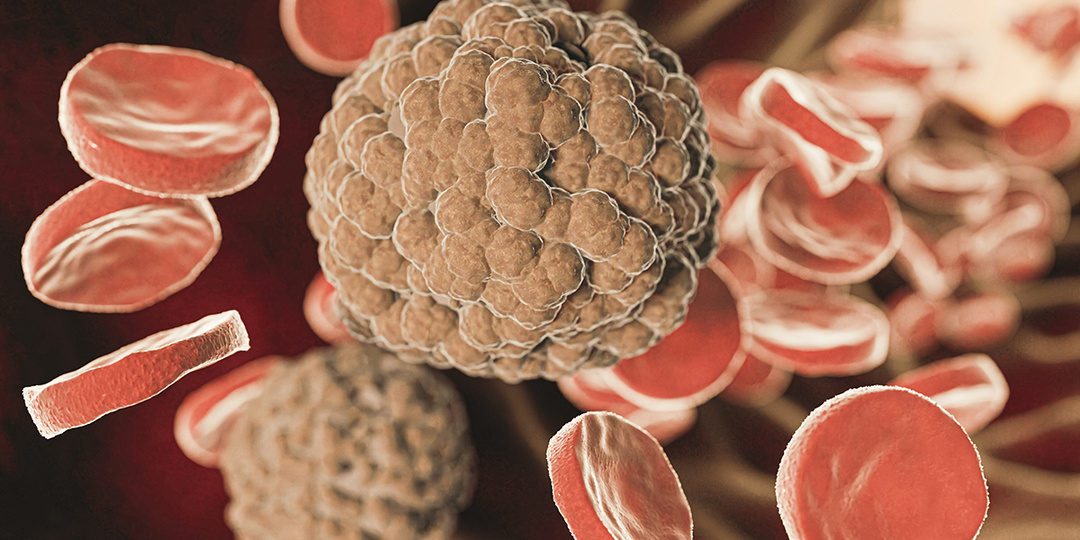 Невидимый процесс: врач рассказал, чем опасен атеросклероз