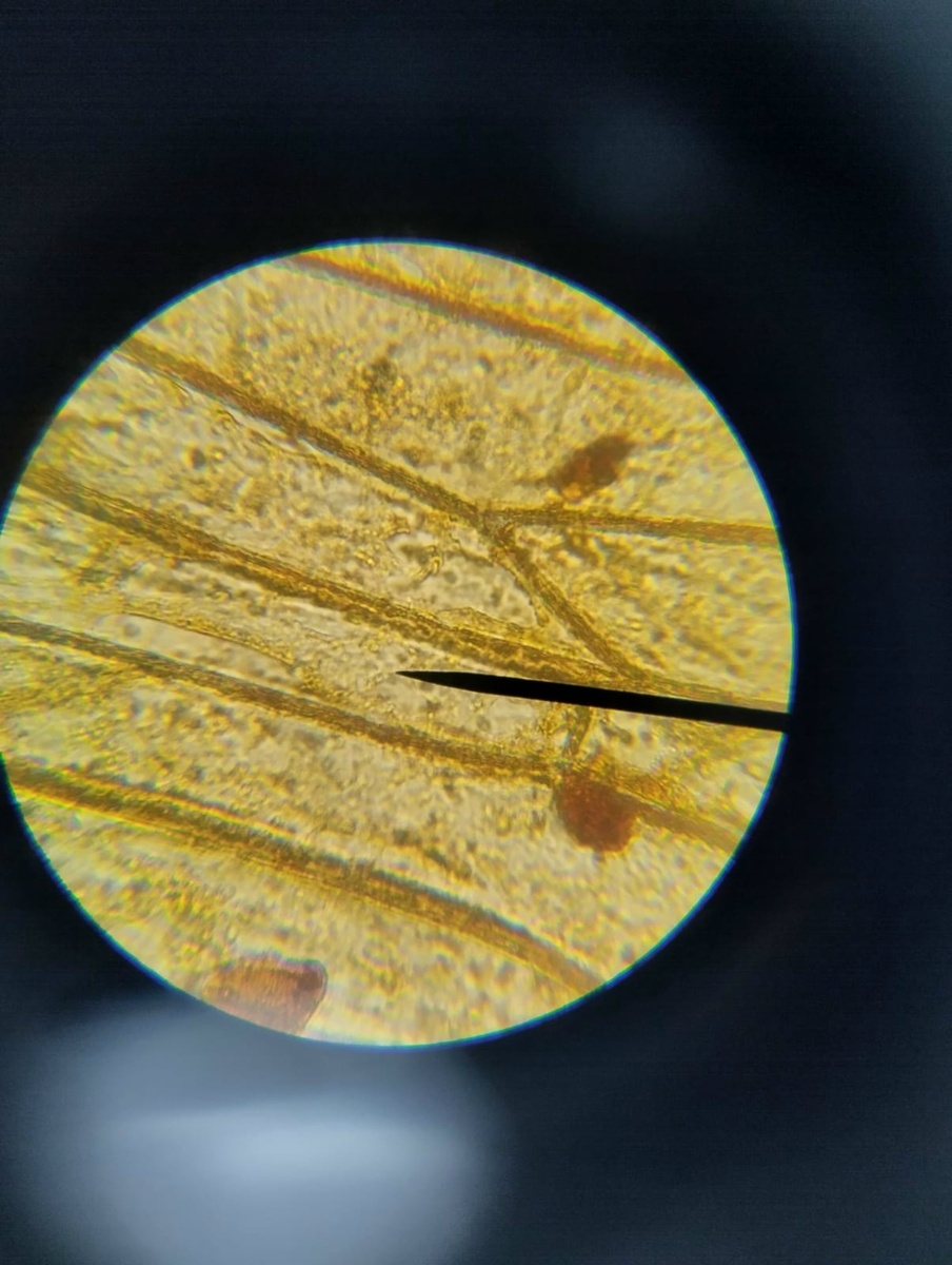 Фотографии из микроскопа