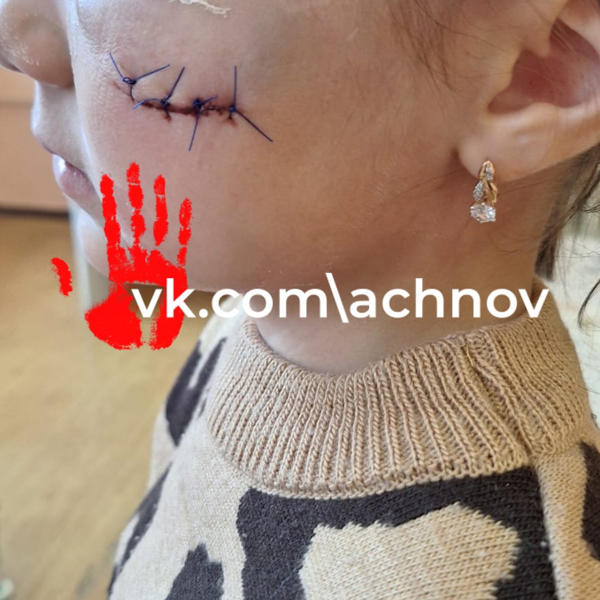 На фото последствия похода в детскую комнату