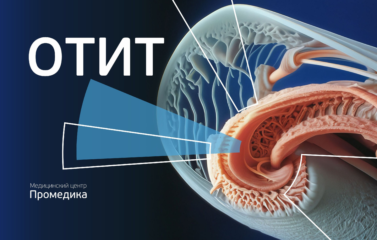 Отит. Как отличить простуду от воспаления уха