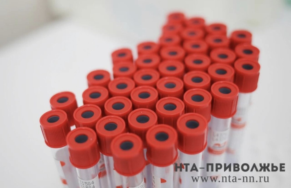    Единичные случаи гриппа выделяются в Нижегородской области