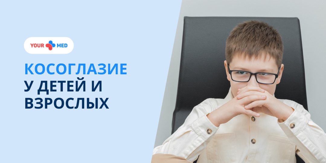 Косоглазие у детей и взрослых