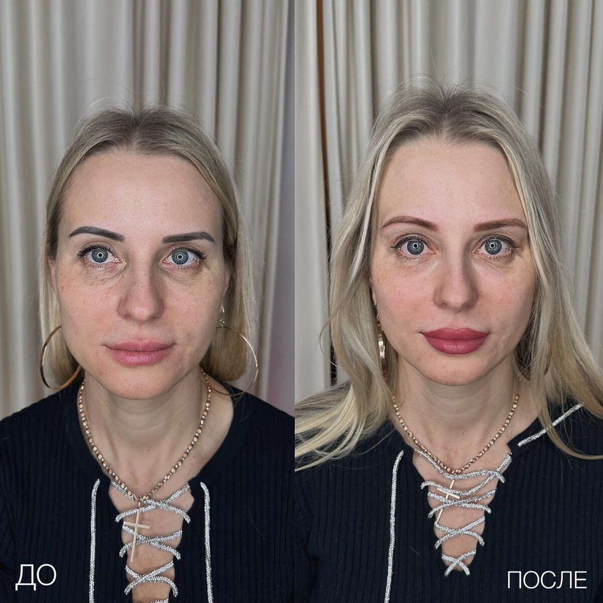 Посмотрите, как девушка преобразилась буквально за пару часов - мы провели процедуру освыетления бровей лазером, перманентный макияж губ и вишенка на торте - камуфляж темных кругов под глазами - это и дает свежий взгляд 