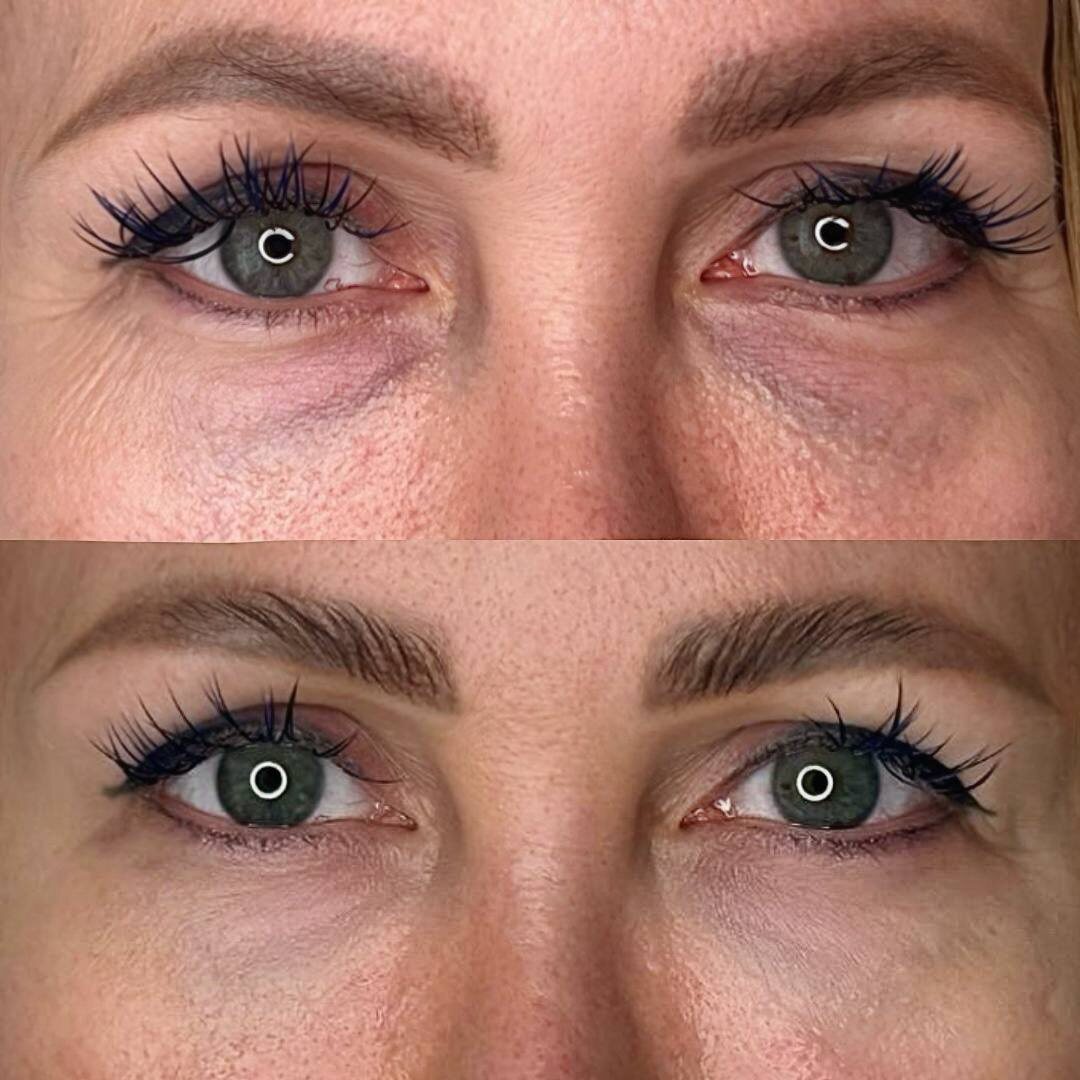 камуфляж темных кругов