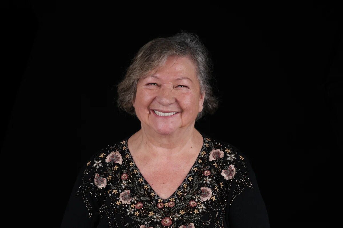 Надежда Валеевна, 84 года. г. Москва, клиника доктора Севака Estetus 