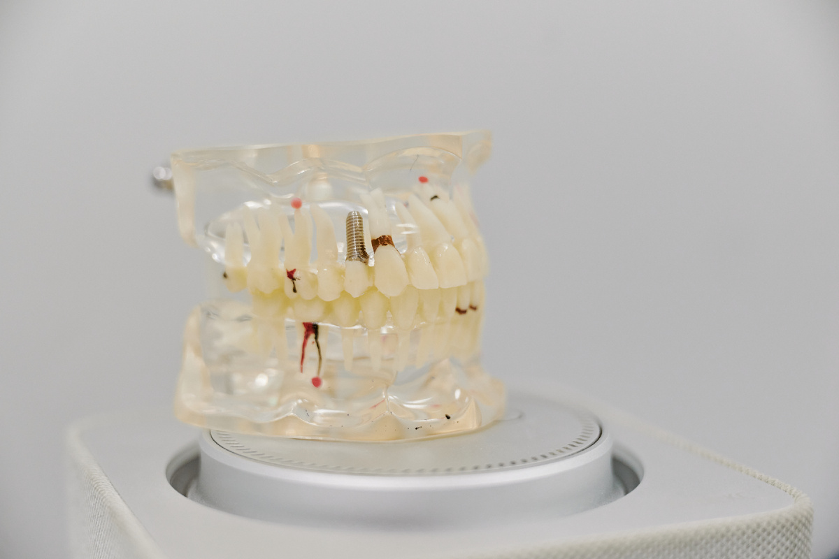 Чем меньше бактерий в полости рта, тем ниже риск возможных осложнений.