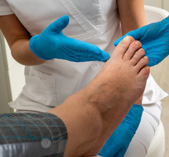 Подолог - специалист, который на осмотре может выявить потерю чувствительности стоп,