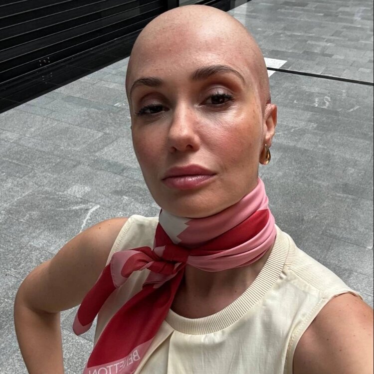 Лысая Агата Муцениеце для роли в «Химкинских ведьмах»📷
