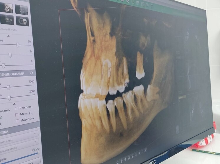     Специалист посоветовала людям с сахарным диабетом посещать стоматолога два раза в год. Фото: Архив МК в Великом Новгороде