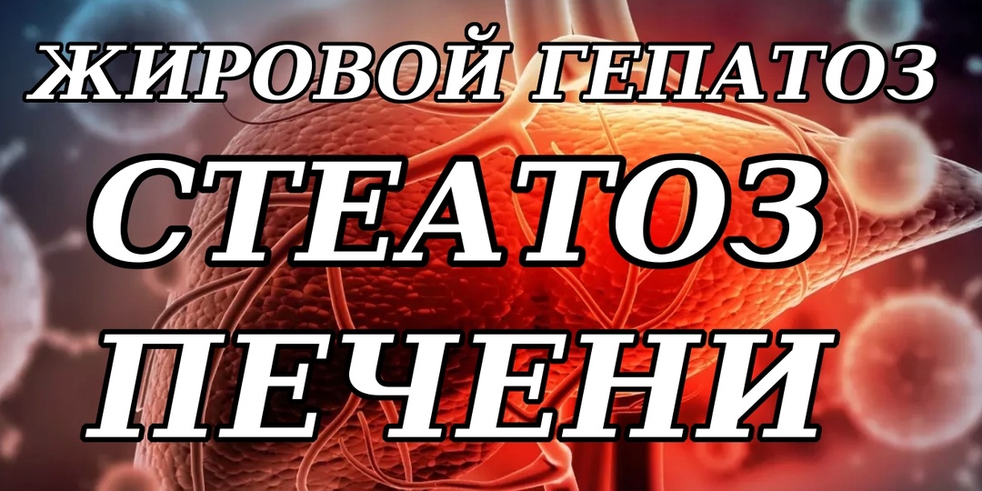 Сильная усталость оказалась признаком жирового гепатоза (история)