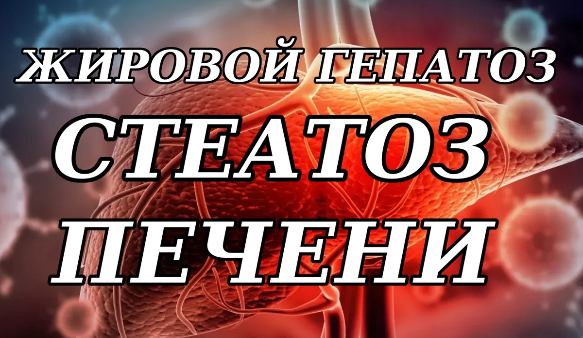 Сильная усталость оказалась признаком жирового гепатоза (моя история)