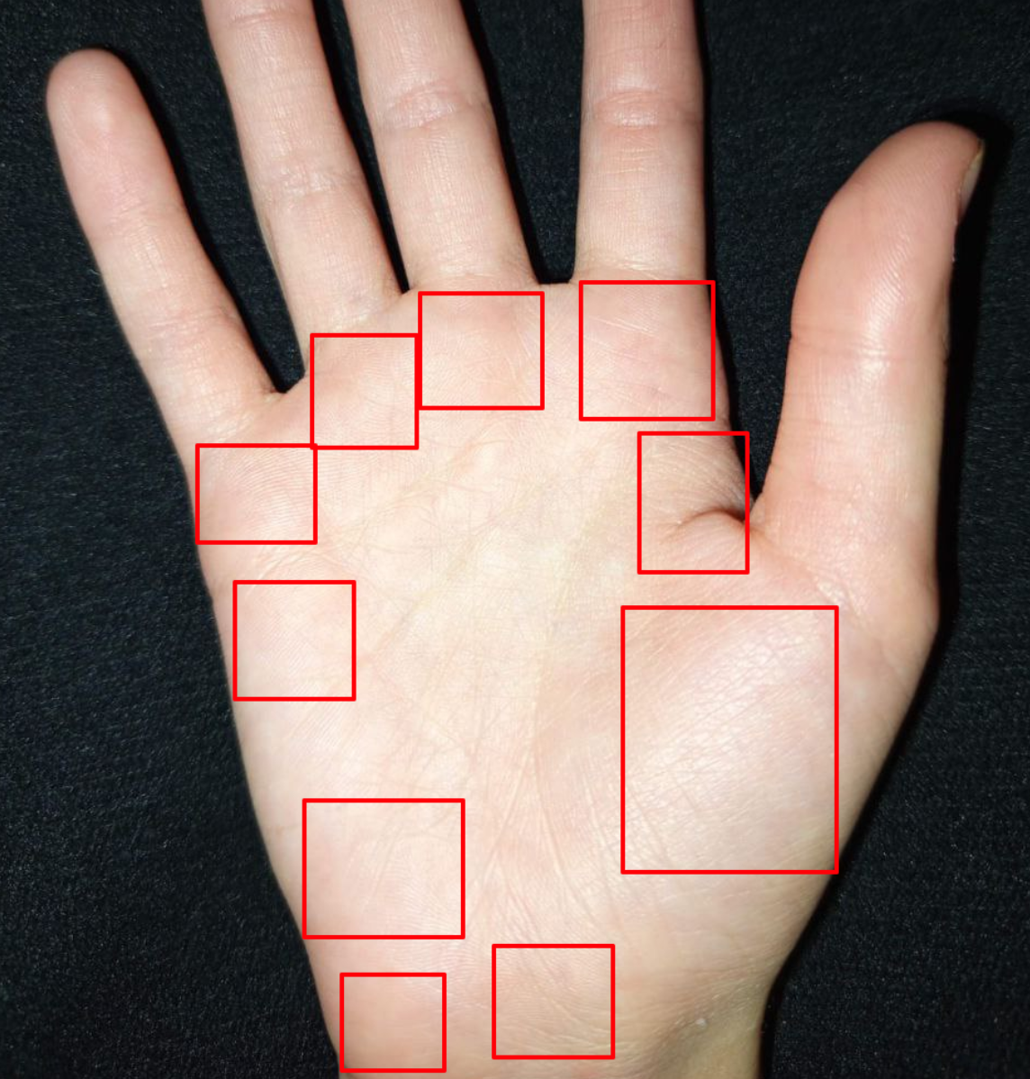 Зоны холмов на ладони