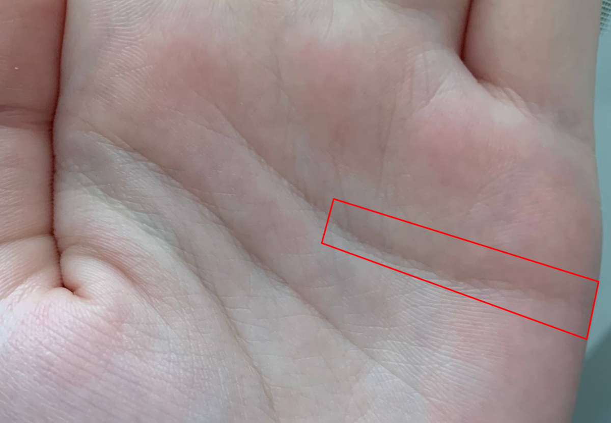 На данной ладони в принципе все основные линии "цепеобразные"