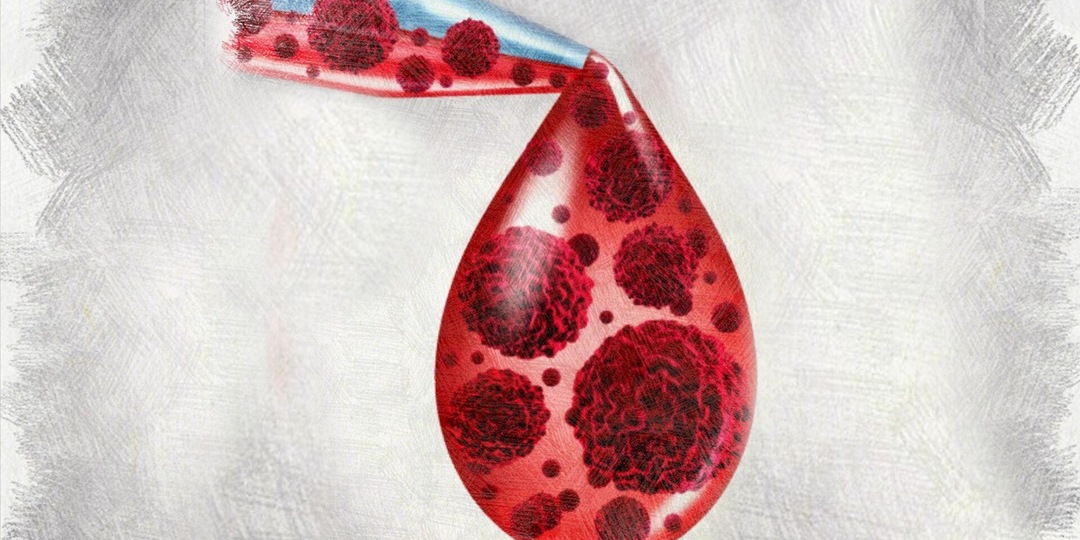 8 «скрытых загустителей» крови, о которых почти не говорят