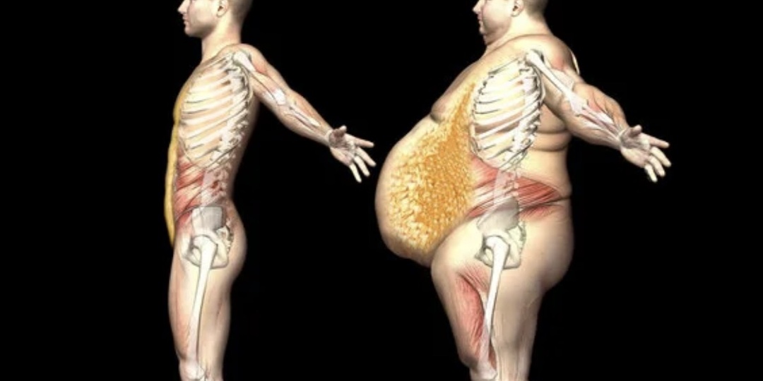 Висцеральный жир. Как убрать ?!